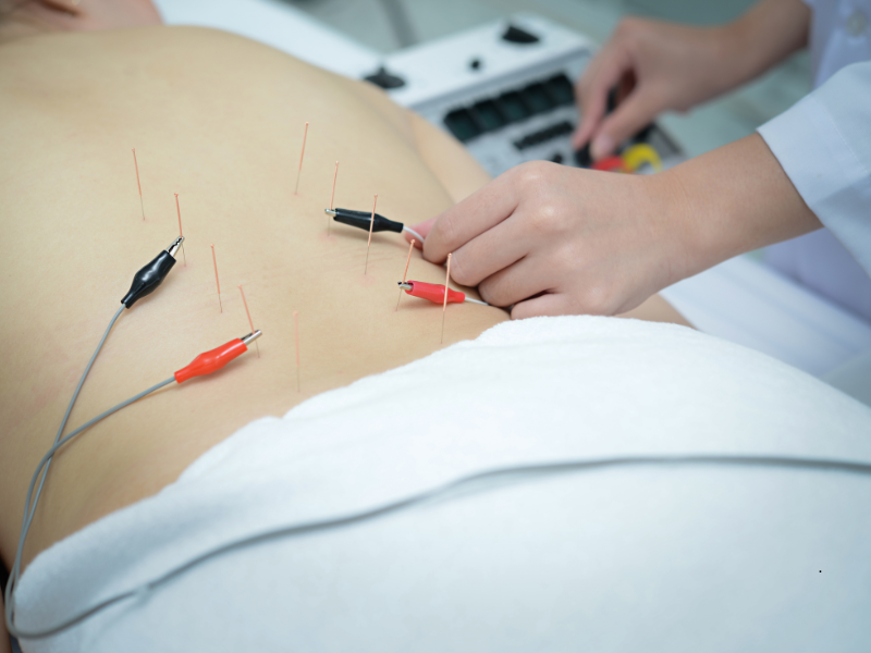 Elektroakupunktura energije morja